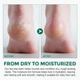 thumbnail image 6 of Tea Tree Foot Balm, Athletes Foot Cream with Tea Tree Oil & Aloe Vera, Soothe and Nourish Dryness, Sensitive, Tired Skin, 2oz (60g), 6 of 9