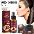thumbnail image 2 of Buy 2 get 10% off Essential oils Essential Coconut oil Hair Growth Oil, Hair Growth Oil, Nourishes The Scalp, Improves Blood Circulation, Itching And Dryness Of The Scalp, 30ml, 2 of 5