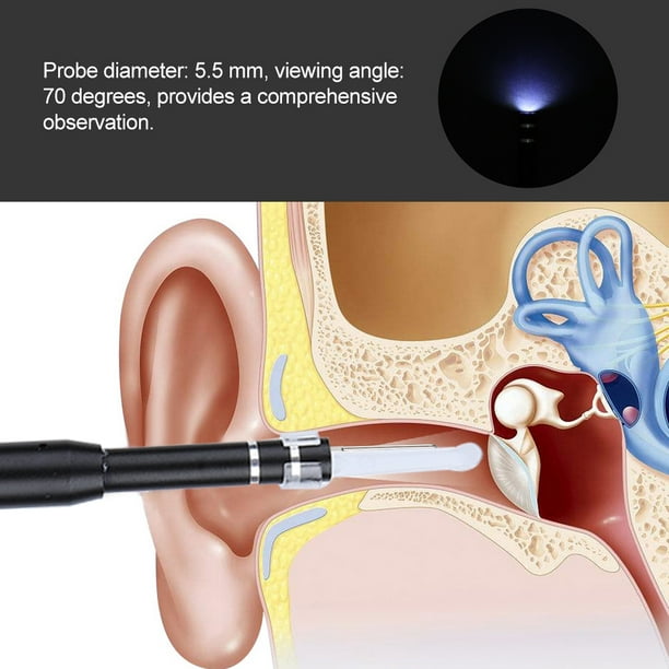 Ear Cleaning Endoscope, Great Performance 3in1 Ear Endoscope, Earwax