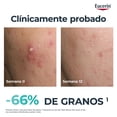 thumbnail image 4 of Serum Eucerin Dermopure Triple Effect 40ml, 4 of 8