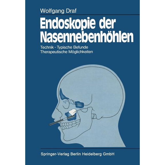Endoskopie Der Nasennebenhöhlen: Technik - Typische Befunde, Therapeutische Möglichkeiten, (Paperback)