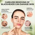 thumbnail image 3 of Mascarilla eliminadora de puntos negros LANBENA Upgraded 2.0 Bamboo Charcoal, 3 of 9
