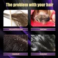 thumbnail image 3 of Champú para el crecimiento del cabello de romero, productos antipérdida, reparación de folículos del cuero cabelludo, champú para el crecimiento del cabello de cebolla, eficaz dentro de 7 días, 3 of 5