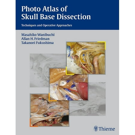 UPC: 9781588905215 | Photo Atlas of Skull Base Dissection: Techniques and Operative Approaches (Hardcover)
