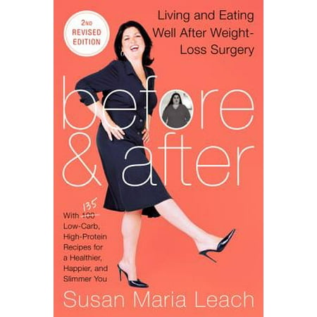 Before & After : Living and Eating Well After Weight-Loss (Best Before And After Weight Loss)