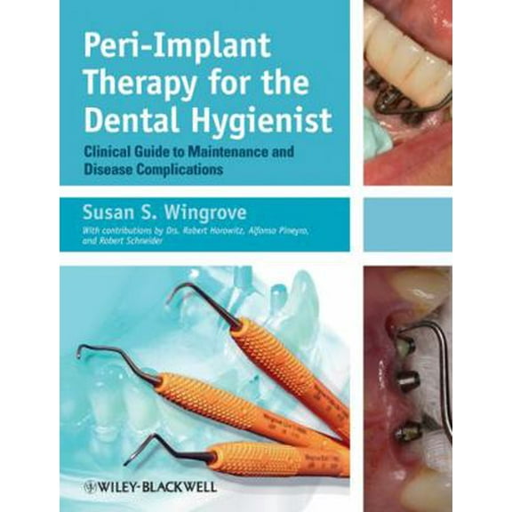 Pre-Owned Peri-Implant Therapy for the Dental Hygienist: Clinical Guide to Maintenance and Disease Complications (Paperback) 0470962852 9780470962855