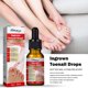 thumbnail image 4 of Nail Help Aceite de tratamiento de corrección de uñas encarnadas, gotas para uñas encarnadas, suavizante de uñas para un fácil recorte (10 ml) kaili Sencillez, 4 of 5