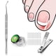 thumbnail image 1 of Kit de corrección de uñas de los pies ANGGREK Tiras correctoras de uñas encarnadas con caja de almacenamiento, 1 of 8