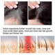 thumbnail image 4 of Ginger Hair Growth Essence Hair Care Hair Root Care Spray Strong Repair Growth Liquid -, 4 of 4
