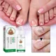thumbnail image 2 of Líquido de reparación de uñas, líquido para uñas descoloridas, gruesas, arrugadas, Fungals para uñas descoloridas, rotas y agrietadas, S5F64, 2 of 5