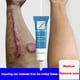thumbnail image 1 of ScarAway Advanced Scar Gel - 15 g, crema eficaz para eliminar cicatrices de acné, estrías y quemaduras, 1 of 10