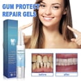 thumbnail image 3 of 5pcs Teeth Whitening Gel Dental Whitening Material Tooth Bleach Whitener Gel, 3 of 5