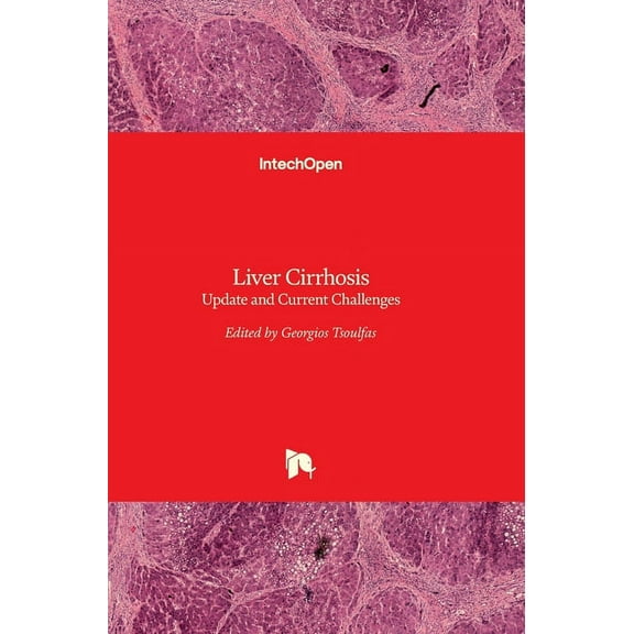 Liver Cirrhosis: Update and Current Challenges (Hardcover) by Georgios Tsoulfas