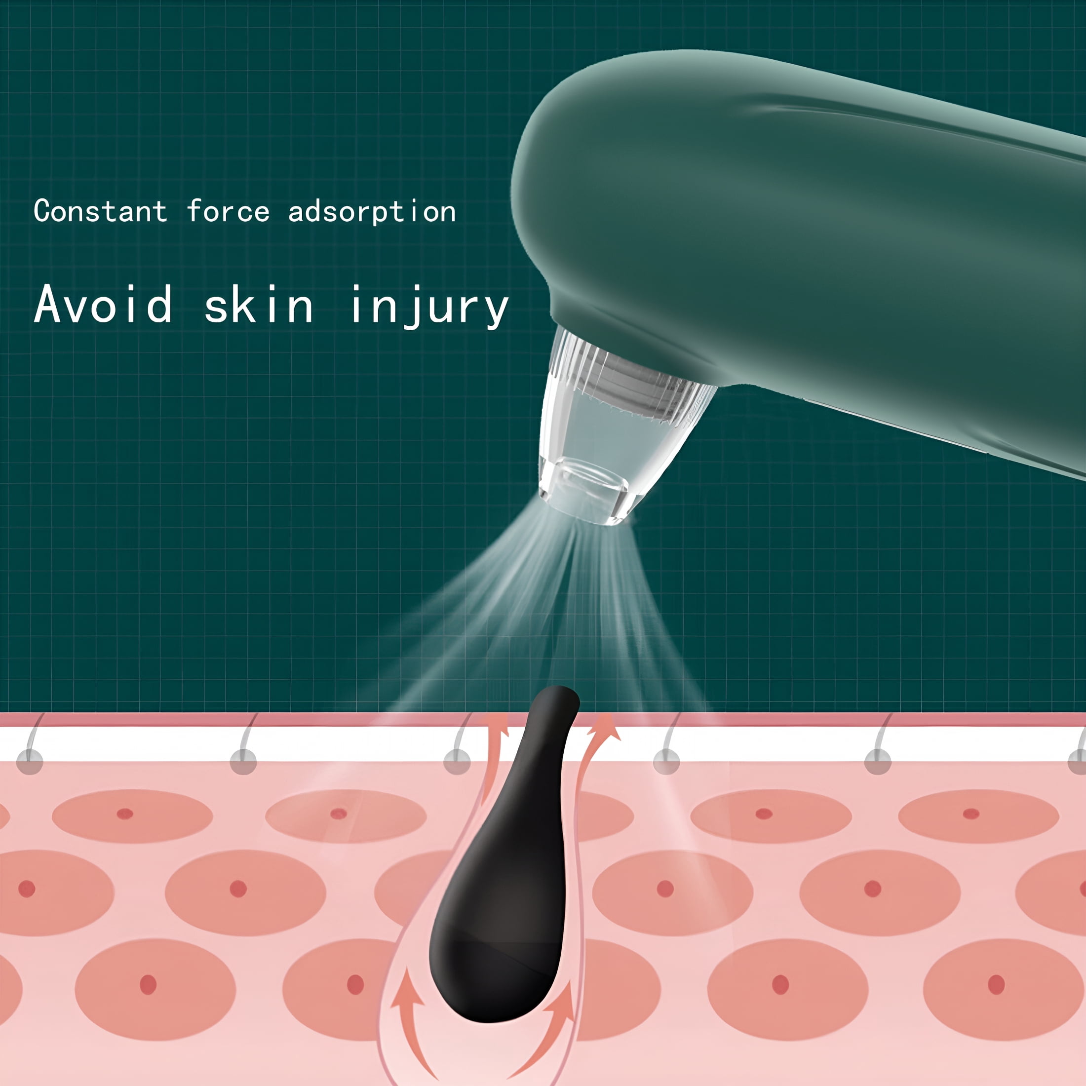 XIRQI Blackhead Remover Pore Vacuum with Camera-Upgraded Visual Facial Pore Cleaner with Electric Wifi Black Head Remover Suctioner