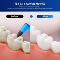 thumbnail image 3 of 2pcs Tartar Remover For Teeth, Tooth Polishing Kit For Removing Plaque & Stain (white & Blue), 3 of 5