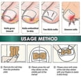 thumbnail image 2 of Ingrown Toenail Corrector Patch Pedicure, 2 of 3