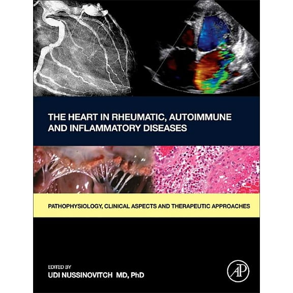 The Heart in Rheumatic, Autoimmune and Inflammatory Diseases: Pathophysiology, Clinical Aspects and Therapeutic Approach, (Hardcover)