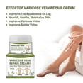 thumbnail image 3 of Varicose Vein Cream 50g Varicose Vein Cream Anti-spider And Vein Removal Varicose Leg Care, 3 of 5