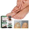 thumbnail image 2 of EELHOE 30ml Nail Treatment Essence for Onychomycosis Mild Non-irritating Nail Bright Shiny Repair Nail Repair Solution, 2 of 5