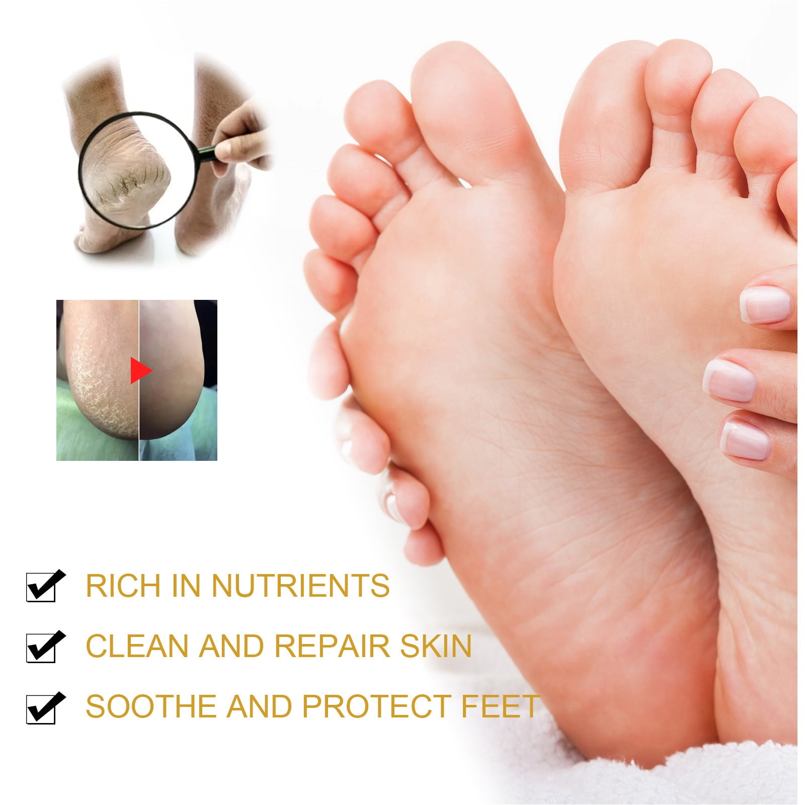 OEM Breathable Hydrating Sock Lotion Gel For Dry Cracked Heels Manufacturer  and Supplier | Suscong