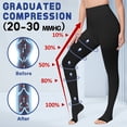 thumbnail image 4 of beister Medical 20-30 mmHg Thigh High Compression Socks, Open Toe Graduated Support Pantyhose for Women & Men, 1 Pair, 4 of 8