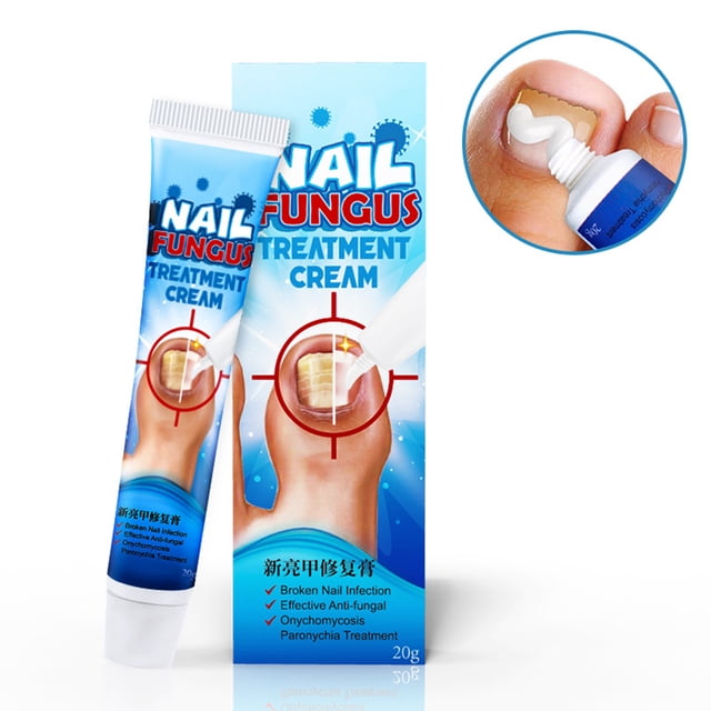 20g Crema para hongos en las uñas Removedor de hongos en las uñas Crema removedora de hongos en las uñas de los pies