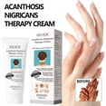 thumbnail image 4 of Crema de tratamiento de terapia de acantosis nigricans, crema reparadora de piel de espina negra, crema hidratante blanqueadora correctora de manchas oscuras, 4 of 5