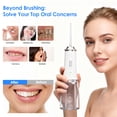 thumbnail image 5 of Hooyapik 45-Day Battery Life 300ML Electric Water Flosser Spot Spray Micro-waterfall System Oral Irrigator Flosser For Implants/Braces/Receding Gums, 5 of 7