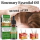 thumbnail image 3 of Aceite de romero para el crecimiento del cabello y el cuidado de la piel, aceite de romero puro y natural para el crecimiento del cabello, aceite esencial de romero, 3 of 5