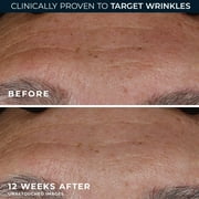 RoC Retinol Correxion Deep Wrinkle Serum with Patented Clinical Retinol, Anti-Aging Face & Neck Serum Paraben-Free, 1 fl oz