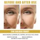 thumbnail image 4 of Esencia para el cuidado de la piel del rostro, Liwei Crema reparadora de oro de 24 quilates 50g para mujeres para reducir las líneas de expresión Liwei Crema reparadora de oro, 4 of 5