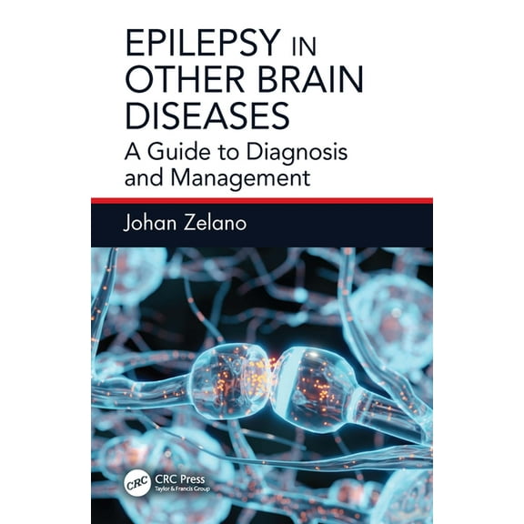 Epilepsy in Other Brain Diseases: A Guide to Diagnosis and Management, (Paperback)