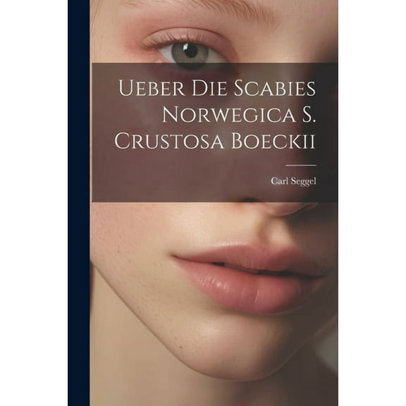 Ueber Die Scabies Norwegica S. Crustosa Boeckii (Paperback)