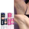 thumbnail image 3 of Hair Removal Spray, 30ml, Suitable for All Skin Types, Shrink Pores, 3 of 8
