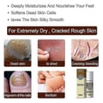 thumbnail image 4 of Fungal Combat Feet Spray Foot Sterilize Spray Anti-fungal Infection Toe Treatment Onychomycosis Anti Ba, 4 of 4