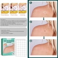 thumbnail image 2 of 120 Uds parche eliminador de marcas en la piel pegatinas para el tratamiento de verrugas yeso de absorción rápida JShteea  Cuidado Belleza, 2 of 6