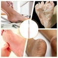 thumbnail image 3 of ACDANC Foot File Callus Remover Long Handled Toe Cleaning Brush Foot Scrubber Toe Crevice Cleaning Brush Foot Care Pedicure Tool, 3 of 7