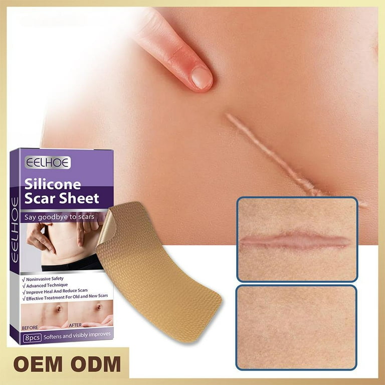 4 Pack Silicone Scar Sheets, Strips, Tape - Keloid, C-Section, Surgical -  Scars Removal Treatment - Silicon Gel Cream Patch Bandage - Tummy Tuck  Surgery - 31.6 