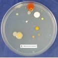 thumbnail image 2 of Nutrient Agar Kit, Includes 20 Sterile Petri Dishes with Lids & 20 Sterile Cotton Swabs, 2 of 4