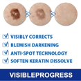 thumbnail image 2 of CHAO Ungüentos limpiadores de verrugas de 20 g Crema antimanchas para atenuar los nevos de la piel para uso externo Caja de 3 unidades de 20 g, 2 of 5