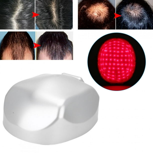Zerodis LED Hair Growth Helmet With For Makeing Hair Grow Thicker And Fuller For Men Use, Promote Hair Regrowth Equipment For Anti Hair Loss - Zerodis LED Hair Growth Helmet With For Makeing Hair Grow Thicker And Fuller For Men Use, Promote Hair Regrowth Equipment For Anti Hair Loss -