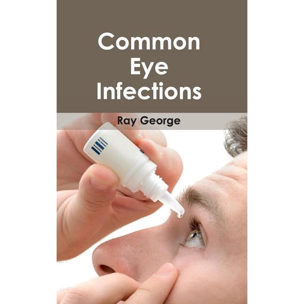 Common Eye Infections (Hardcover)
