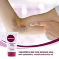 thumbnail image 5 of Dermend Bruise Cream Extra Strength,Bruise Cream Extra Strength Fast Healing Thin Skin,Dermend Arnica Bruise Cream with Vitamin K - Moisturizer for Bruising on Arms,Legs & Hands - 4.5 Oz, 5 of 5