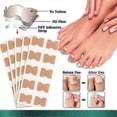 thumbnail image 3 of Ingrown Toenail Corrector Patch Pedicure, 3 of 3