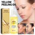 thumbnail image 4 of Acetato Exfoliante Blanqueador E Hidratante Xihbxyly 50 ml Para Pieles Sensibles, 4 of 7