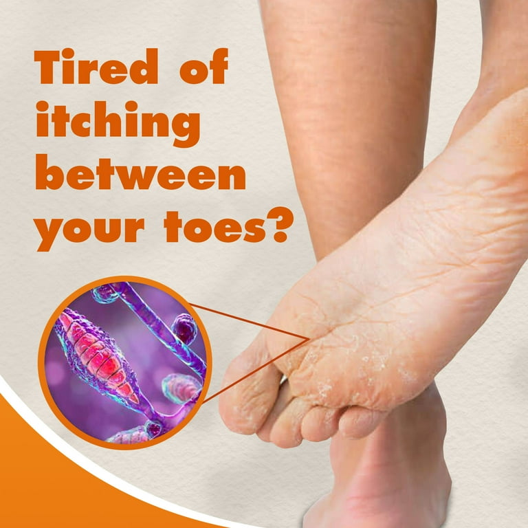 HONGOCURA, Antifungal Cream for Athletes Foot, Jock Itch Maximum