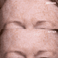 thumbnail image 2 of Wrinkles Schminkles Forehead Single Silicone Patch - Reusable 8-10 Times(1 per pack), 2 of 5