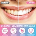 thumbnail image 2 of 2Pack Whitening Toothpaste with Niacinamide, Fresh Breath, Remove Tooth Stains, Enamel Safe, 2 of 8