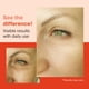 thumbnail image 4 of Eliminador de manchas oscuras Serum Go Radiance Retinol 1% 60 ml, 4 of 6