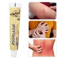 thumbnail image 4 of Crema para el Tratamiento de la Psoriasis de 20g Crema Corporal Calmante para el Sarpullido Blanco Rojo Rosa Varios Problemas de la Piel Ingredientes Naturales sin Hormonas ANGGREK Otros, 4 of 8